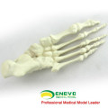 TF12 (12323) Solid Foam Normal Anatomy Large Left Fused Foot Modelo ortopédico